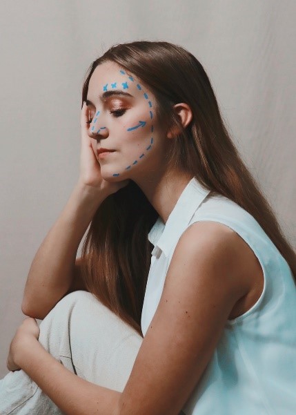 A girl with marks of Botox on her face